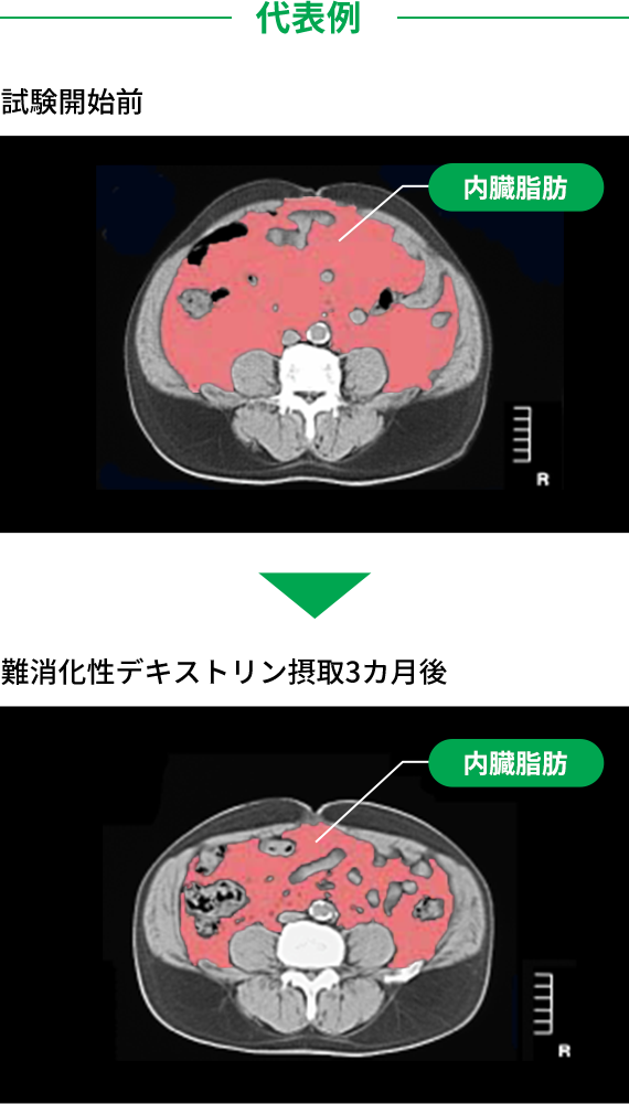 体脂肪低減作用 難消化性デキストリン 機能性素材 製品 事例紹介 松谷化学工業株式会社